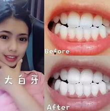明星牙齿怎么清洗图片,揭秘牙齿清洗图片背后的秘密